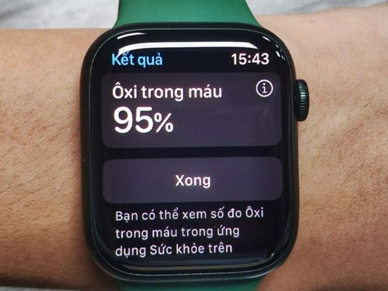 có nên dùng apple watch không